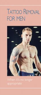 Tattoo Removal For Men - When It's No Longer Appropriate